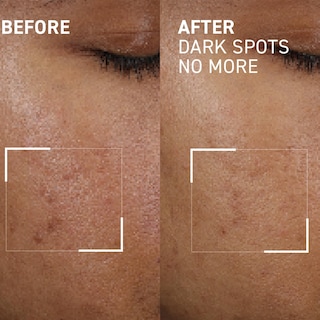 Foto 3 | Foto 3 | Concentrado Minimizador De Manchas Dr. Brandt Bright This Way, 15 Ml - Venta Internacional.