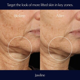 Foto 3 | Foto 3 | Sérum Estée Lauder Perfectionist Pro Rapid Firm + Lift 30 Ml - Venta Internacional.