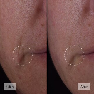 Foto 4 | Foto 4 | Sérum Facial Philosophy Dose Of Wisdom Bouncy Skin Rebuilding - Venta Internacional.