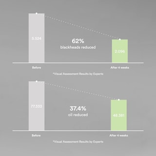 Foto 4 | Foto 4 | Essence Abib Heartleaf Essence, Relajante, 50 Ml, Para Rostro - Venta Internacional.
