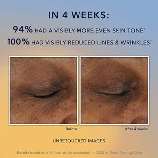 Foto 3 | Foto 3 | Sérum Facial Roc 10% De Vitamina C Antienvejecimiento Para Manchas Oscuras, 30 Ml - Venta Internacional.