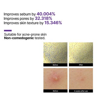 Foto 5 | Foto 5 | Sérum Some By Mi Retinol Reactivante Intenso 30 Ml Con Retinol Al 0,1% - Venta Internacional.