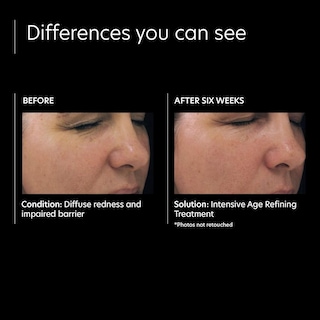 Foto 4 | Foto 4 | Sérum Pca Skin Intensive Antienvejecimiento Con Retinol 0,5% 30 Ml - Venta Internacional.