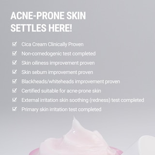 Foto 4 | Foto 4 | Crema Hidratante Rovectin Cica Care Para Eliminar Imperfecciones, 50 Ml - Venta Internacional.