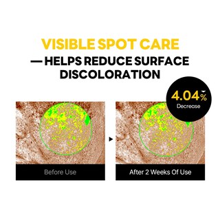 Foto 5 | Foto 5 | Crema Round Lab Vita Niacinamida Dark Spot 50 Ml Para El Cuidado De La Piel Coreano - Venta Internacional.