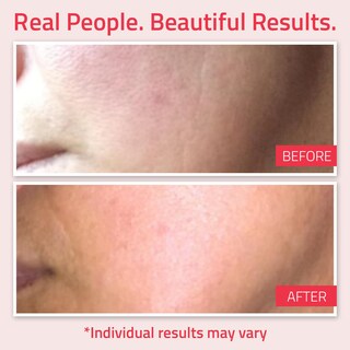 Foto 4 | Foto 4 | Crema Hidratante De Retinol Yeouth Para Rostro 120 Ml Con Ácido Hialurónico - Venta Internacional.