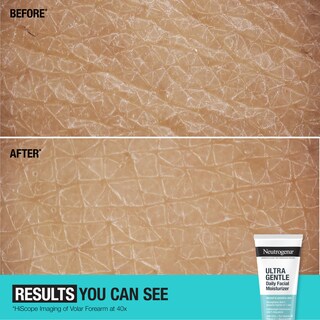 Foto 7 | Foto 7 | Hidratante Facial Neutrogena Sin Fragancia 100 Ml Vitamina D - Venta Internacional.