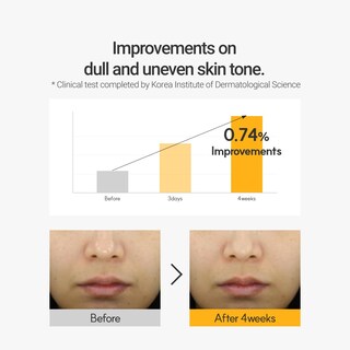 Foto 6 | Foto 6 | Sérum Rovectin Vita Para Eliminar Manchas Oscuras Y Tono De Piel 30 Ml - Venta Internacional.