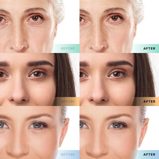 Foto 5 | Foto 5 | Set Trío De Sérum Facial Skincare Cosmedica Con Vitamina C Y Retinol - Venta Internacional.