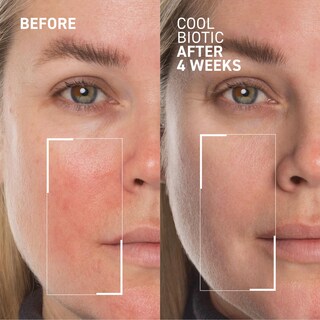 Foto 3 | Foto 3 | Crema Dr. Brandt Cool Biotic Para Aliviar El Enrojecimiento 50 Ml (paquete De 2) - Venta Internacional.