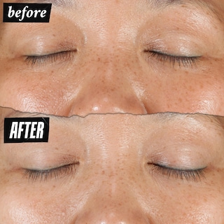 Foto 4 | Foto 4 | Sérum Kiehl's Clearly Corrective Dark Spot 50 Ml Con Vitamina C - Venta Internacional.