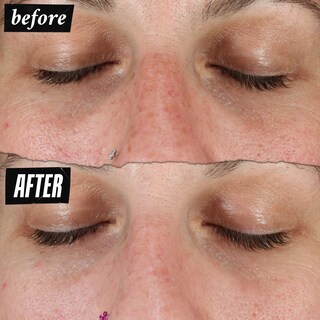 Foto 5 | Foto 5 | Sérum Kiehl's Clearly Corrective Dark Spot 50 Ml Con Vitamina C - Venta Internacional.