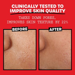 Foto 5 | Foto 5 | Tónico Facial Thayers Sin Alcohol Con Pétalos De Rosa Y Hamamelis, 90 Ml - Venta Internacional.