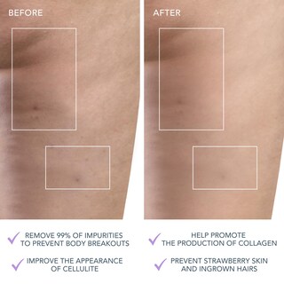 Foto 4 | Foto 4 | Cepillo Corporal Foreo Luna 4 Exfoliante Corporal Lavanda - Venta Internacional.