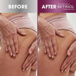 Foto 4 | Foto 4 | Crepe Reafirmante Antienvejecimiento Con Retinol, 120 Ml Con 4 Onzas - Venta Internacional.