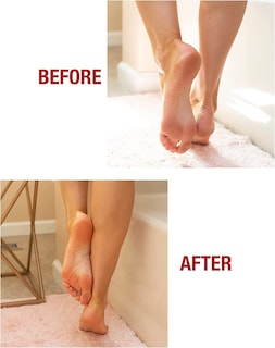 Foto 5 | Foto 5 | Pomada Curativa Para La Piel Kerasal Intensive Foot Repair 30 Ml - Venta Internacional.