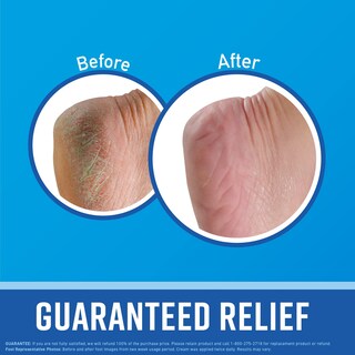 Foto 2 | Foto 2 | Crema Para Pies O'keeffe's For Healthy Feet, Tubo De 90 Ml - Venta Internacional.