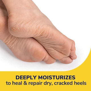 Foto 3 | Foto 3 | Loción Dr. Scholl's Severe Cracked Heel Repair, 75 Ml, Con 25% De Urea - Venta Internacional.
