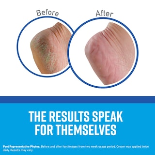 Foto 2 | Foto 2 | Crema Para Pies O'keeffe's Healthy Feet 90 Ml (paquete De 3) - Venta Internacional.