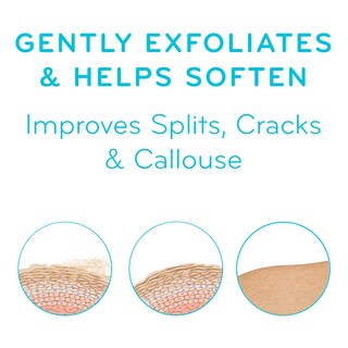 Foto 3 | Foto 3 | Crema Para Pies Con Amlactin Therapy 90 Ml (paquete De 2) - Venta Internacional.
