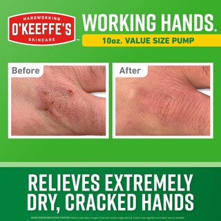 Foto 2 | Foto 2 | Crema de Manos O'keeffe's Extreme Dry 10 Oz - Venta Internacional