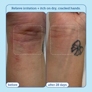 Foto 5 | Foto 5 | Crema Para Aliviar Las Manos Skinfix Reduce El Enrojecimiento 90 Ml Piel Seca - Venta Internacional.