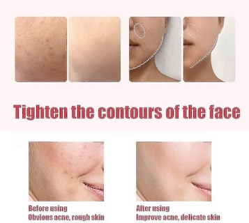 Foto 5 | Foto 5 | Limpiador Facial Dispositivo De Belleza Limpieza Ultrasónica De Poros Rosa - Venta Internacional.