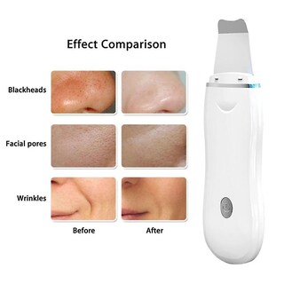 Foto 4 | Foto 4 | Limpiador Facial Huoguo Depurador Ultrasónico De Piel Blanco - Venta Internacional.
