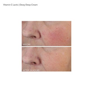 Foto 7 | Foto 7 | Crema Dr. Dennis Gross Con Vitamina C, Láctica Y Profunda, 60 Ml - Venta Internacional.