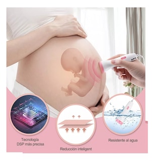 Foto 4 | Foto 4 | Detector De Frecuencia Cardíaca Fetal, Belug Portátil Blanco/rosa