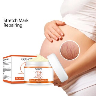 Foto 5 | Foto 5 | Loción Corporal Y Crema De Masaje Para Estrías Huoguo Que Atenúa Las Líneas Finas - Venta Internacional.