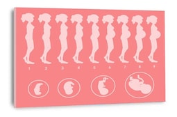 Cuadro Decorativo Canvas Embarazo Para Consultorio Medico