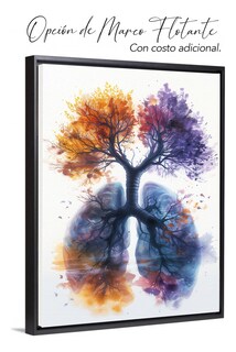 Foto 5 | Foto 5 | Cuadro Paisaje Arbol Pulmones Colorido 90x60cm.