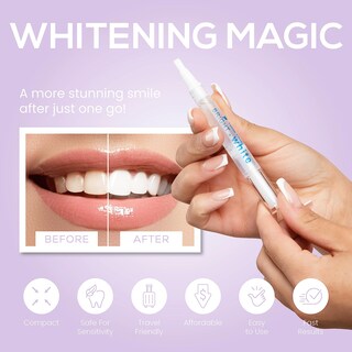 Foto 4 | Foto 4 | Bolígrafo Blanqueador De Dientes Ganador Del Premio Venus Visage (2 Bolígrafos) - Venta Internacional.