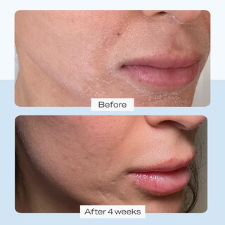 Foto 2 | Foto 2 | Crema Hidratante First Aid Beauty Ultra Repair 240 Ml - Venta Internacional.