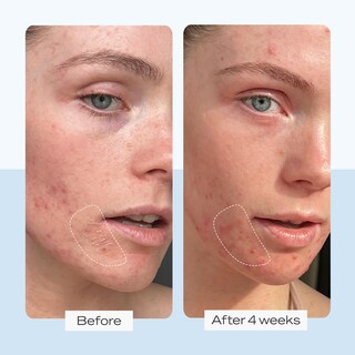 Foto 4 | Foto 4 | Crema Hidratante First Aid Beauty Ultra Repair 240 Ml - Venta Internacional.