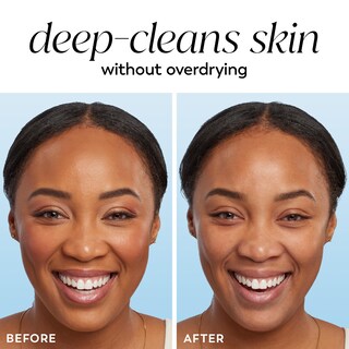 Foto 6 | Foto 6 | Limpiador Facial Olay Gentle Cleansing Melts Sin Fragancia 64 Unidades - Venta Internacional.