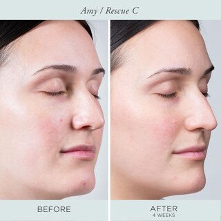 Foto 5 | Foto 5 | Crema Para Ojos Pur Minerals Rescue C Iluminadora Vitamina C Y Péptido 15 Ml - Venta Internacional.
