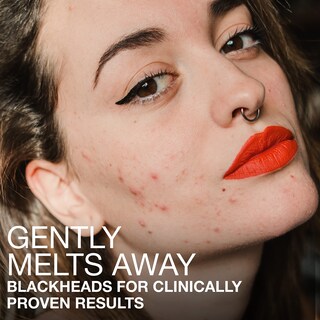 Foto 4 | Foto 4 | Sérum Facial Neutrogena Stubborn Blackheads 30 Ml Con Ácidos - Venta Internacional.