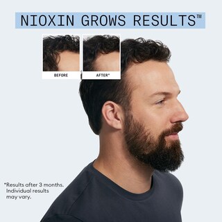 Foto 6 | Foto 6 | Kit Anticaída Champú Nioxin 240 Ml Y Tratamiento Para La Caída Del Cabello 70 Ml - Venta Internacional.