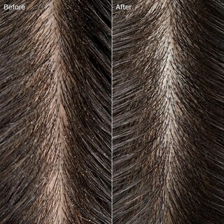 Foto 6 | Foto 6 | Rinse Tea Tree Special Detox Kombucha 200 Ml Para Todo El Cabello - Venta Internacional.