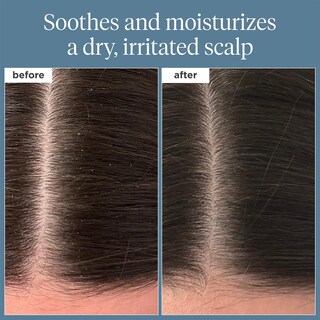 Foto 2 | Foto 2 | Aceite De Prelavado Scalp Revival Rosemary Briogeo 30 Ml - Venta Internacional.