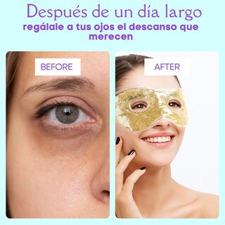 Foto 8 | Foto 8 | Antifaz De Gel Terapia Frío-calor Diseño Glitter | Champagne