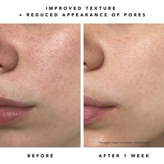 Foto 6 | Foto 6 | Sérum Herbivore Milky Way 10% Aha Y Suavizante De Avena 30 Ml Con Ceramidas - Venta Internacional.