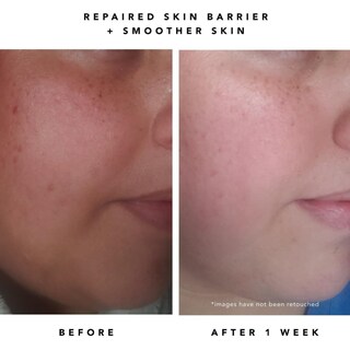 Foto 7 | Foto 7 | Sérum Herbivore Milky Way 10% Aha Y Suavizante De Avena 30 Ml Con Ceramidas - Venta Internacional.