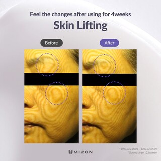 Foto 6 | Foto 6 | Crema Mizon Hyalugen Le Lift Con Ácido Hialurónico Y Colágeno 50 Ml - Venta Internacional.