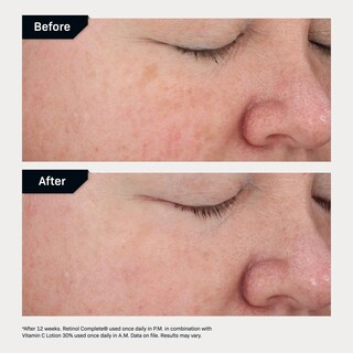 Foto 5 | Foto 5 | Serum Revision Skincare Retinol Complete 0.5 30 Ml - Venta Internacional.