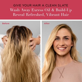 Foto 3 | Foto 3 | Shampoo Unwash Limpiador Antiresiduos 300 Ml Para Todo Tipo De Cabello - Venta Internacional.