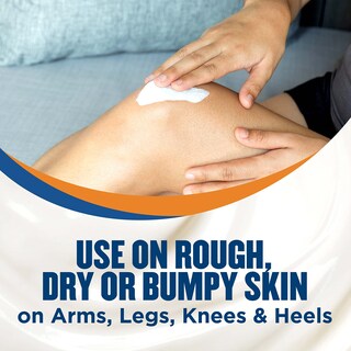 Foto 7 | Foto 7 | Crema Gold Bond Rough & Bumpy Daily Skin 240 Ml Con 7 Humectantes Y 3 Vitaminas - Venta Internacional.