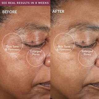 Foto 2 | Foto 2 | Dispositivo De Limpieza Facial Pmd Clean Pro Con Cepillo De Silicona - Venta Internacional.